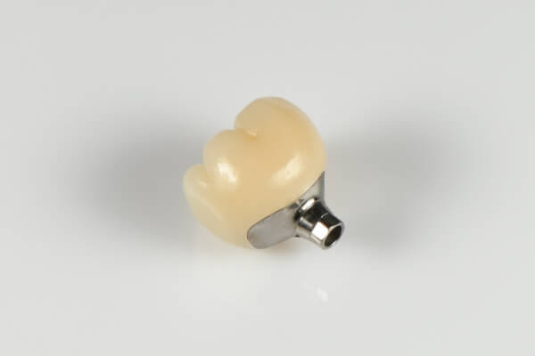 Implant PFM crown
